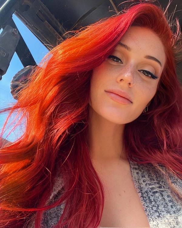 the charm of freckled faces 51 pics 4.html - 51 HD Photos | Premium Gallery 2024