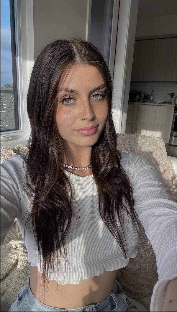 the charm of freckled faces 51 pics 22.html - 51 HD Photos | Premium Gallery 2024