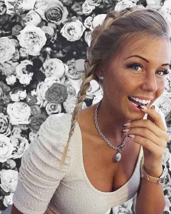 the charm of freckled faces 51 pics 22.html - 51 HD Photos | Premium Gallery 2024