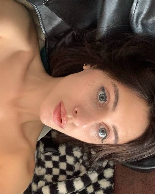 The Charm Of Freckled Faces