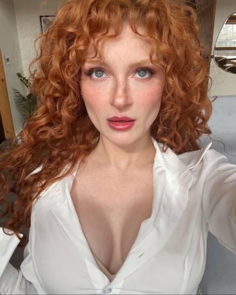 The Charm Of Freckled Faces