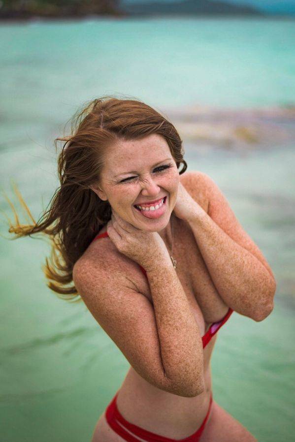 The Charm Of Freckled Faces