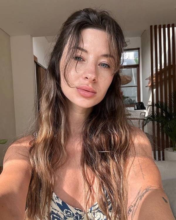 The Charm Of Freckled Faces