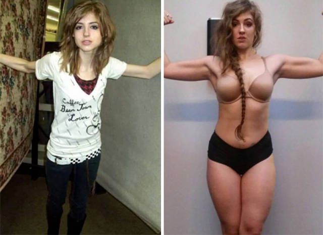 Anorexia Is Not The Final Verdict!