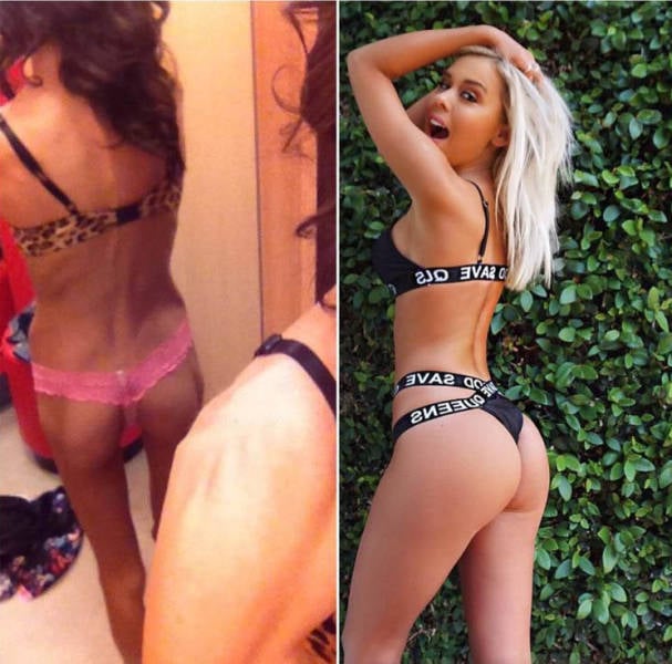 Fighting Anorexia With Beauty