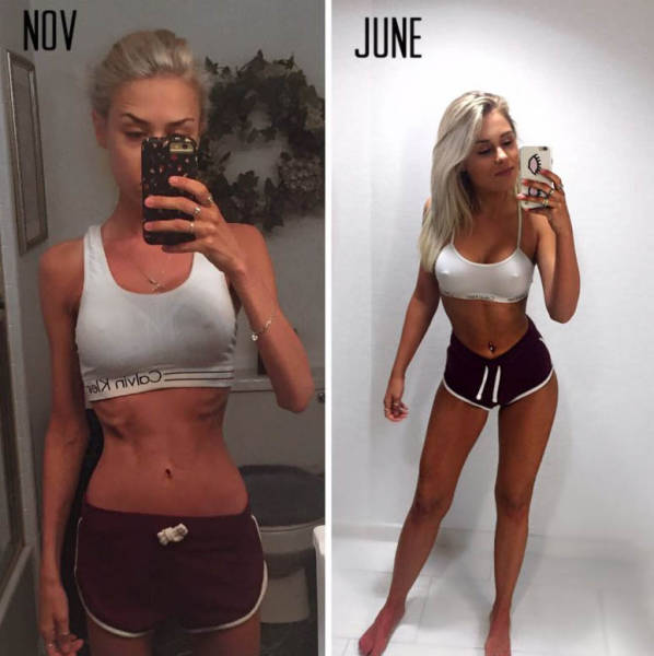 Fighting Anorexia With Beauty