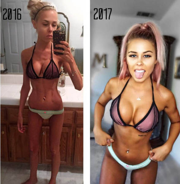 Fighting Anorexia With Beauty