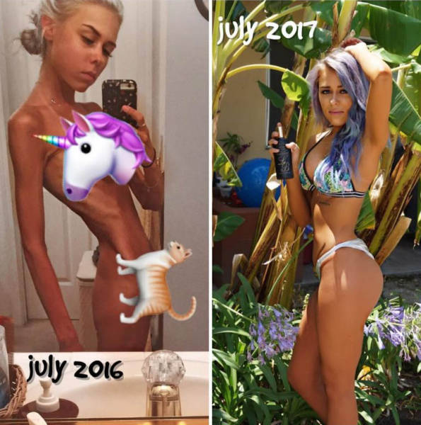 Fighting Anorexia With Beauty