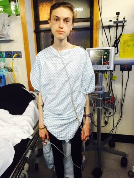 From Anorexia To An Amazing Body!