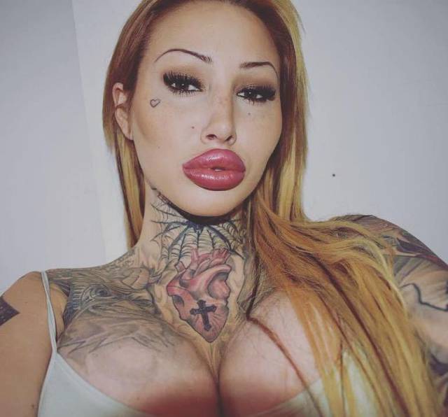 For Them, Lips Are Never Big Enough…