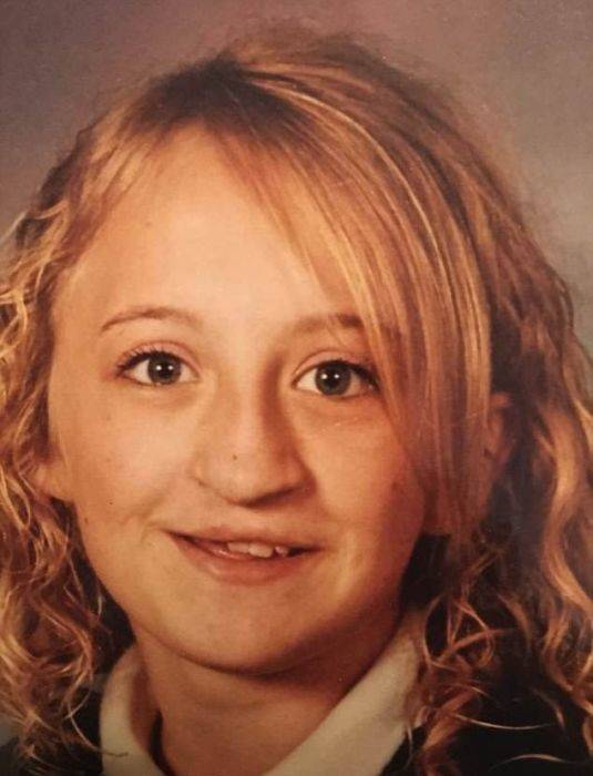 Girl With A Wolf Mouth 10 Operations Later…