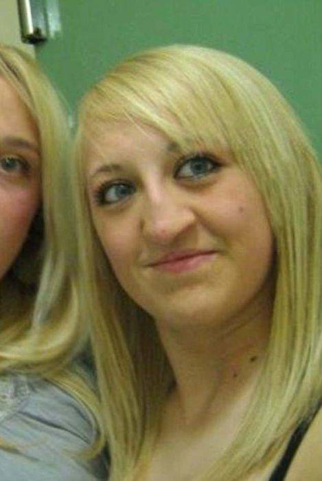 Girl With A Wolf Mouth 10 Operations Later…