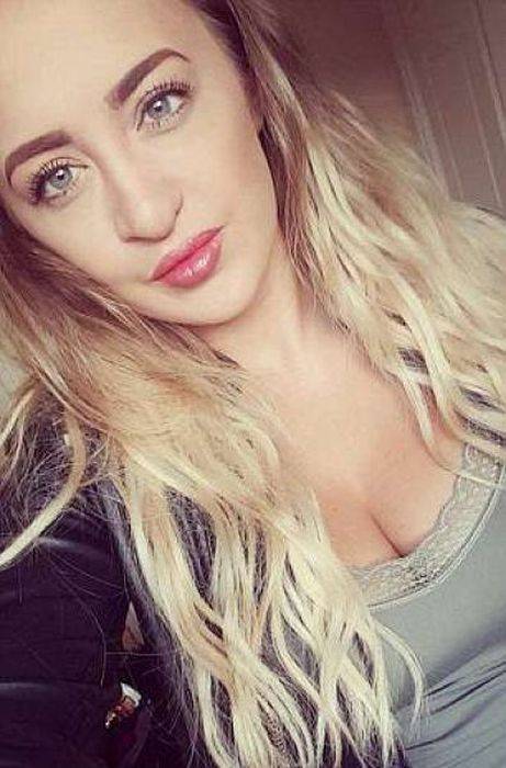 Girl With A Wolf Mouth 10 Operations Later…