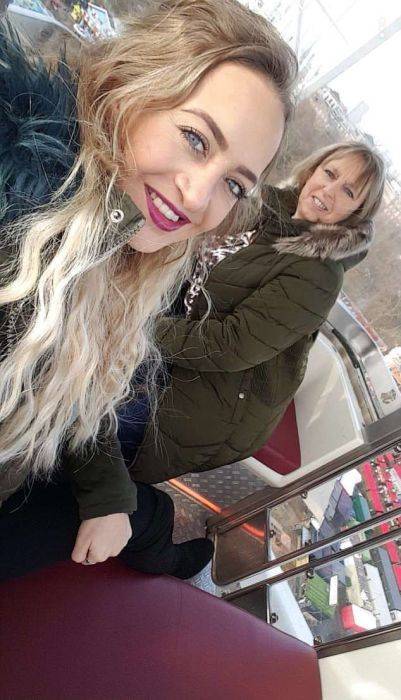 Girl With A Wolf Mouth 10 Operations Later…