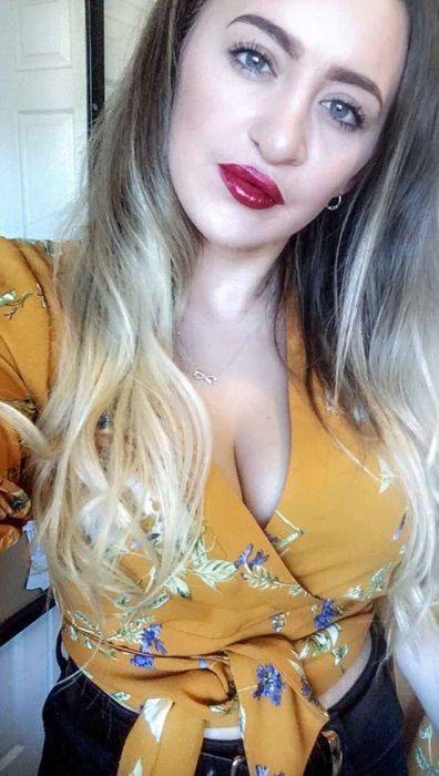 Girl With A Wolf Mouth 10 Operations Later…