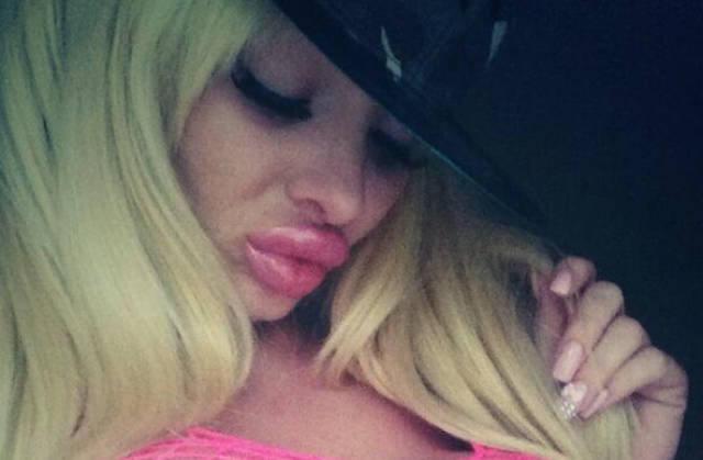 What Have They Done With Their Lips?!