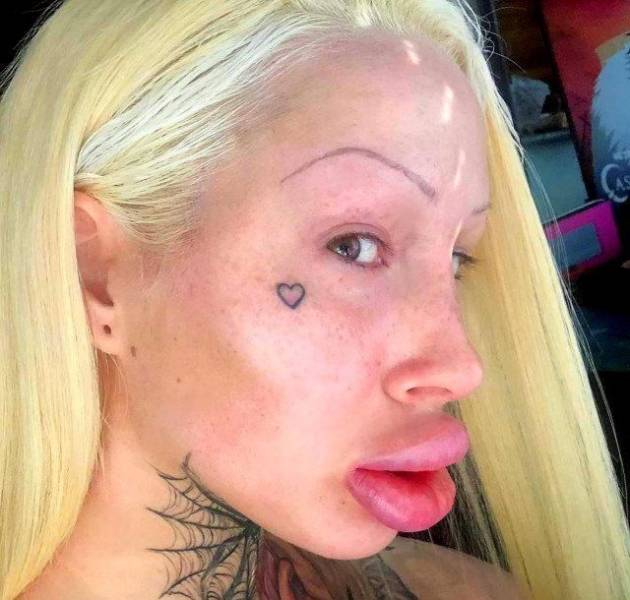 What Have They Done With Their Lips?!