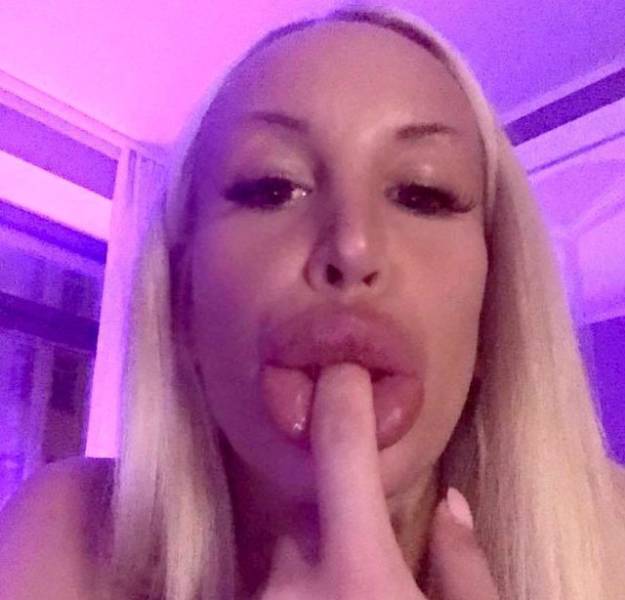 What Have They Done With Their Lips?!