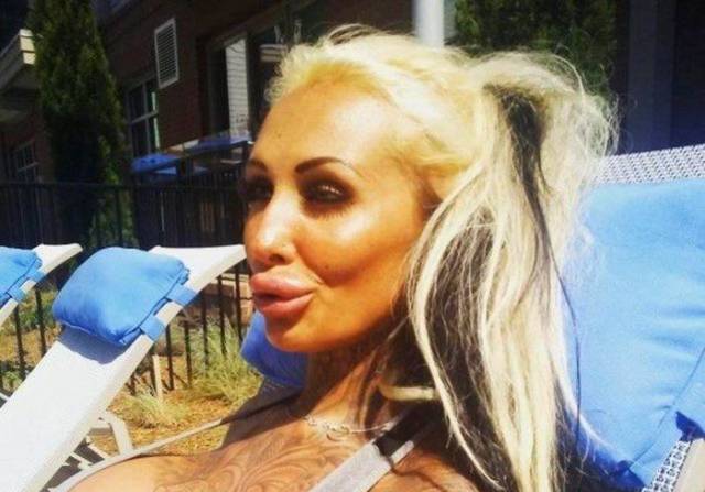 What Have They Done With Their Lips?!