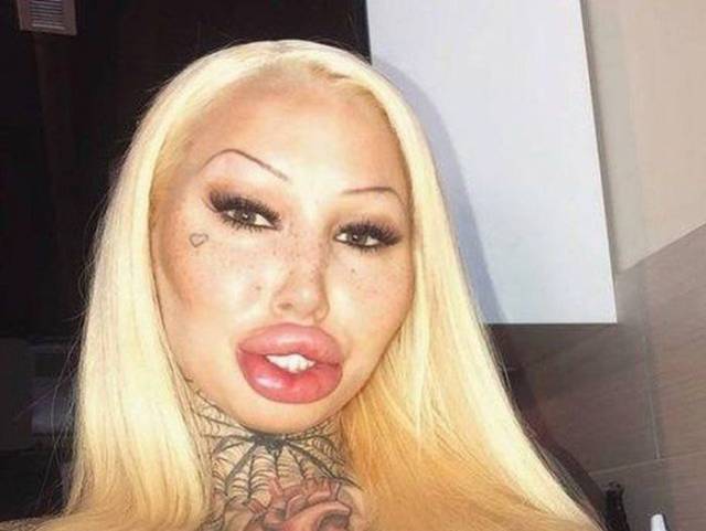 What Have They Done With Their Lips?!