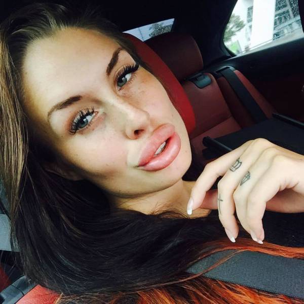 What Have They Done With Their Lips?!