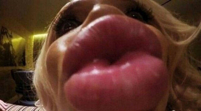 What Have They Done With Their Lips?!