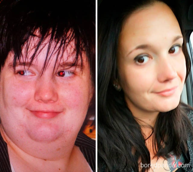 Weight Losses That Are Hard To Believe