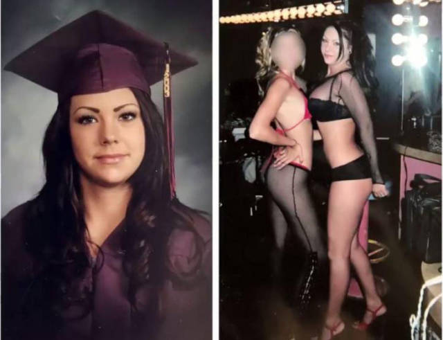 Butt Implants Always Leave A Mark