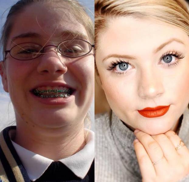 Ugly Duckling? Not Anymore