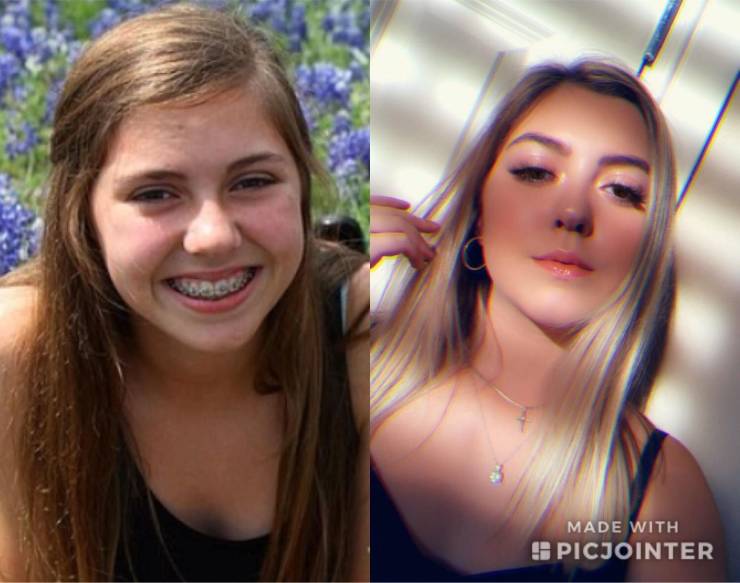 Ugly Duckling? Not Anymore