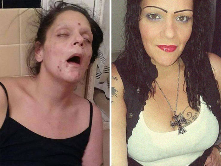 How Drug Addiction Looks Before And After