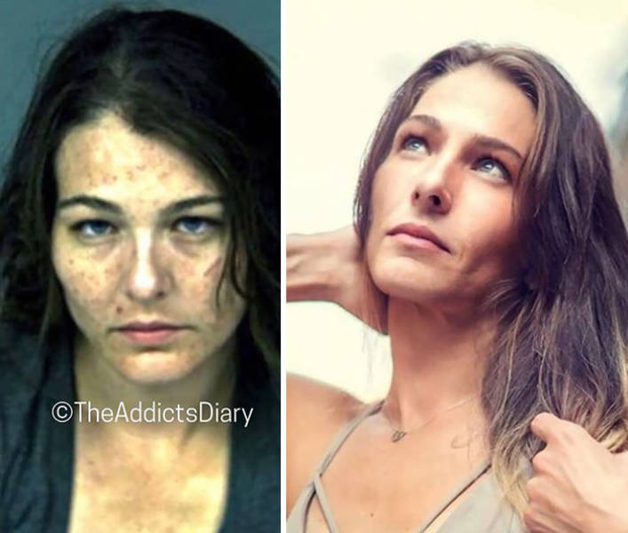 How Drug Addiction Looks Before And After