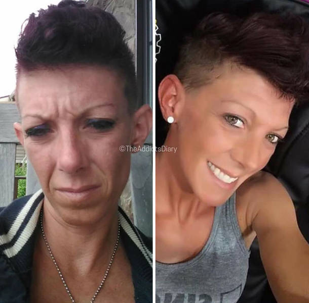 How Drug Addiction Looks Before And After