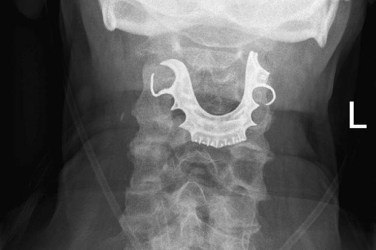 No, Thanks, Do Not Want