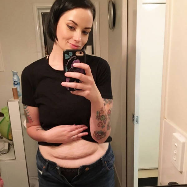 Mom Loses 60 Kilos In A Year