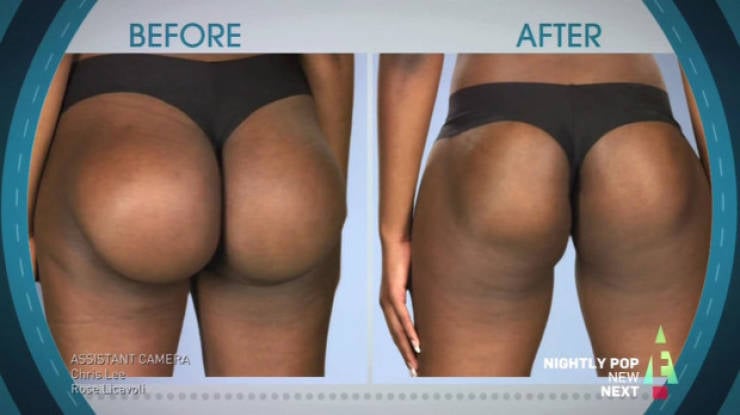 Plastic Surgery Isn’t Always Good For You