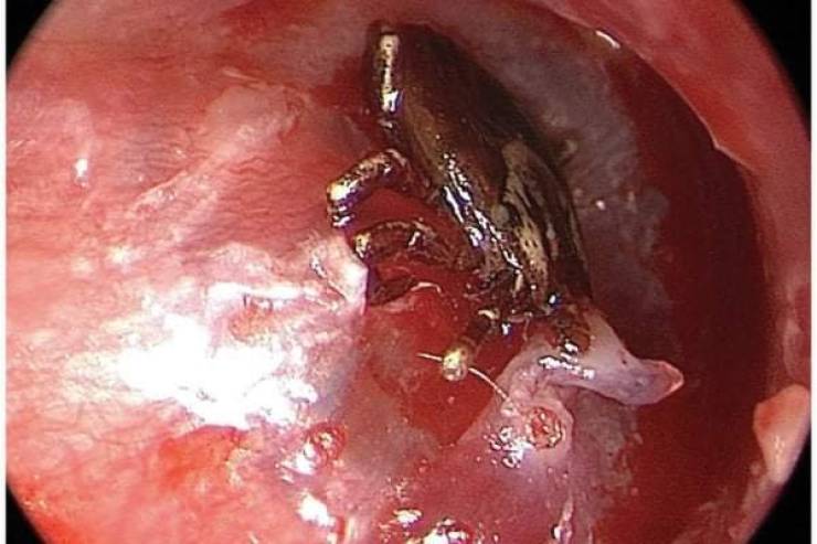 That’s A Real Big NOPE…