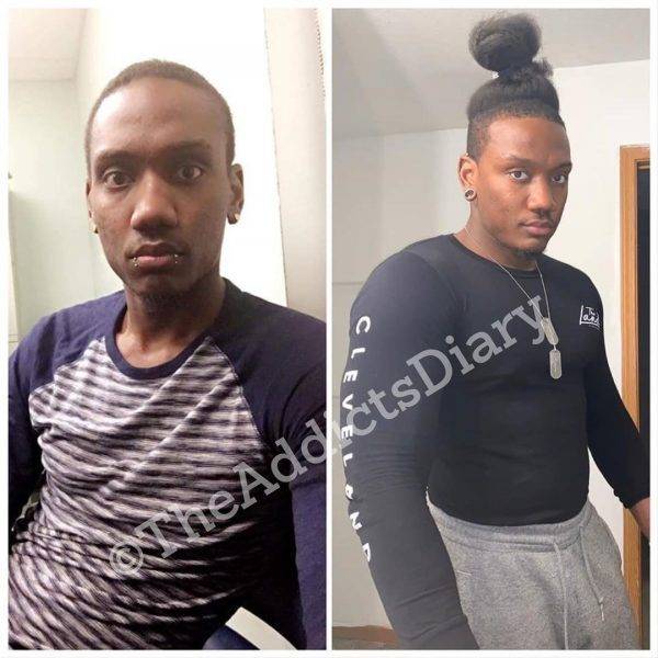 Drug Addicts Have A Chance!