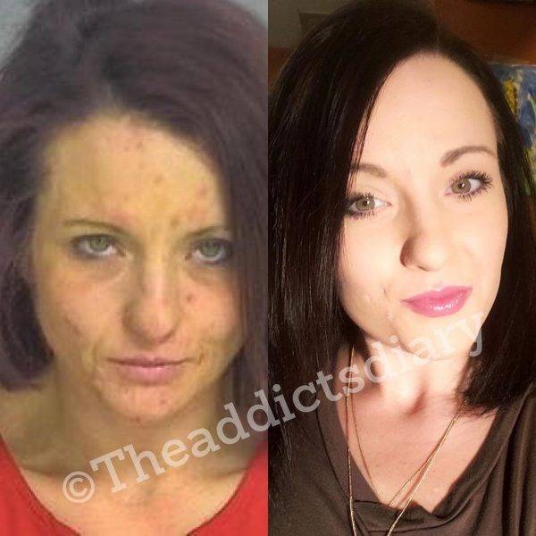 Drug Addicts Have A Chance!