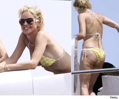 Celebrities and Their Imperfections! (58 pics)