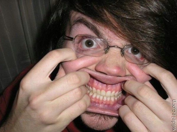 Freaks are around us. Part 2 (62 pics)