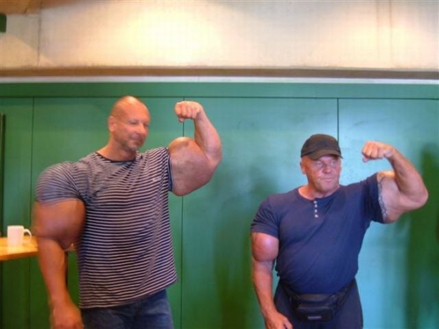 When Synthol Utilisation Goes Wrong! (53 pics)