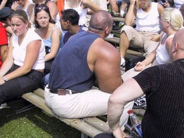 When Synthol Utilisation Goes Wrong! (53 pics)
