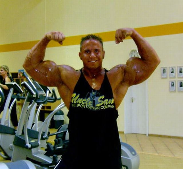When Synthol Utilisation Goes Wrong! (53 pics)