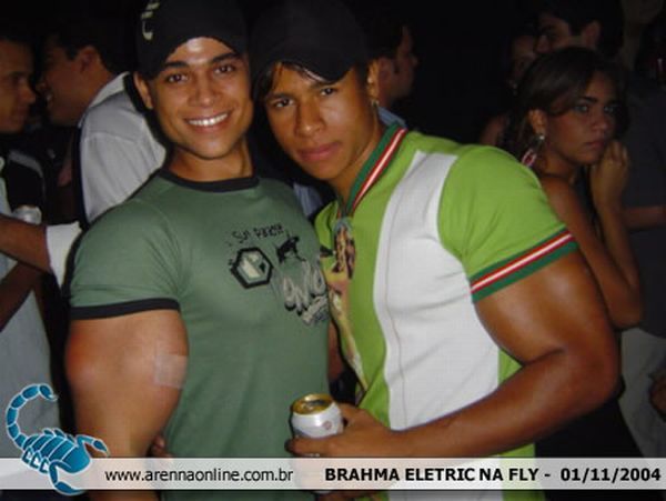 When Synthol Utilisation Goes Wrong! (53 pics)