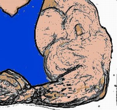 When Synthol Utilisation Goes Wrong! (53 pics)