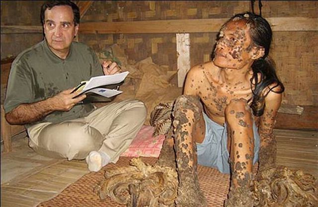 Have You Ever Seen a Tree Man? (19 pics)