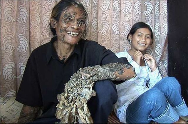 Have You Ever Seen a Tree Man? (19 pics)