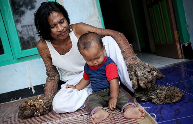 Have You Ever Seen a Tree Man? (19 pics)