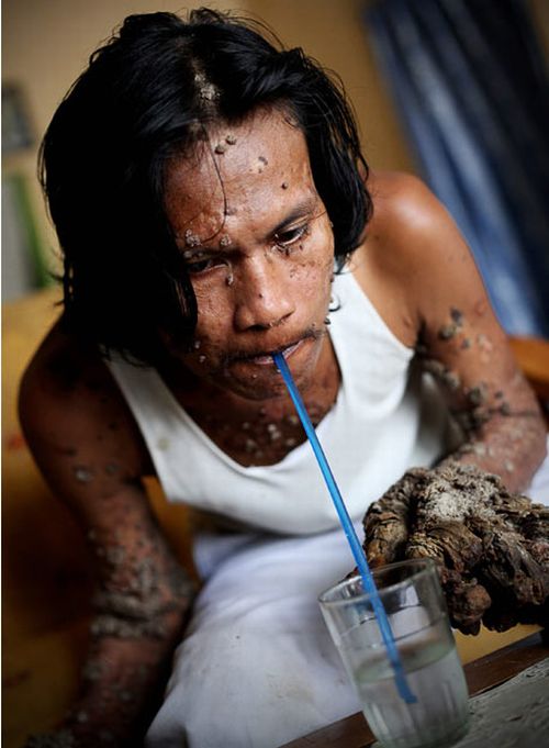 Have You Ever Seen a Tree Man? (19 pics)